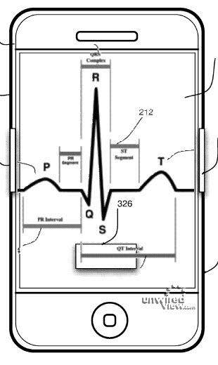 iPhone-EKG1