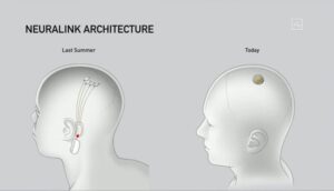 neuralink-update-elon-musk-technology